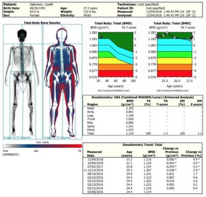 How to Read DEXA Scan Results for Body Composition Analysis: A Comprehensive Guide